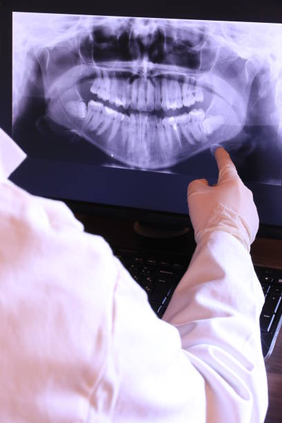 Best Emergency Treatment for Dental Infections or Abscesses in Wixom, MI