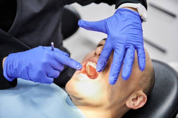 Best Emergency Tooth Extraction in Wixom, MI
